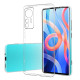 Чохли Xiaomi 12 Lite кращий вибір за ціною від 103грн.